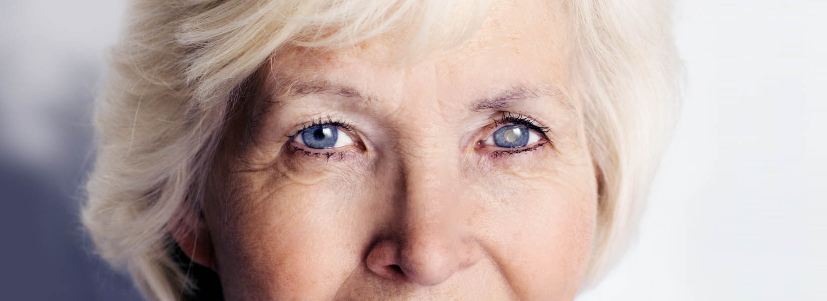 Cataract Surgery in Blue Springs